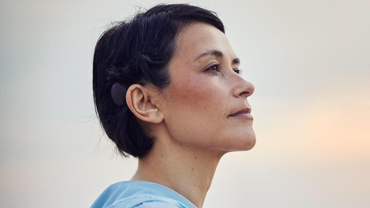 baha hearing aids osia implants